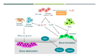 Arthritis and its types