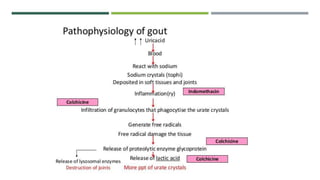 Arthritis and its types