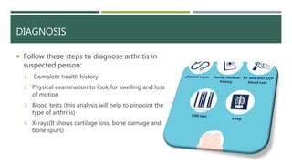 Arthritis and its types