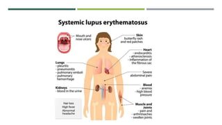 Arthritis and its types