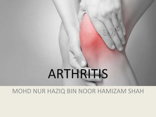 ARTHRITIS
MOHD NUR HAZIQ BIN NOOR HAMIZAM SHAH
 