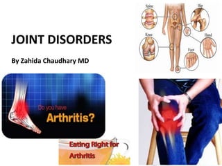 JOINT DISORDERS
By Zahida Chaudhary MD

 