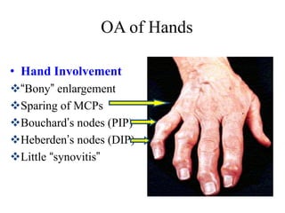 Mpcjs Hand Educational Grand Rounds: Arthritis | PPTX