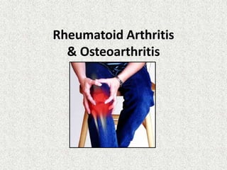 Rheumatoid Arthritis
& Osteoarthritis

 