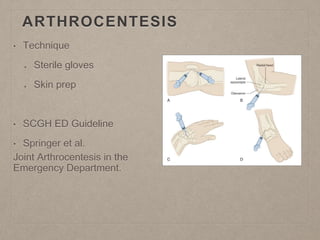ARTHROCENTESIS
• Technique
Sterile gloves
Skin prep
• SCGH ED Guideline
• Springer et al.
Joint Arthrocentesis in the
Emergency Department.
 