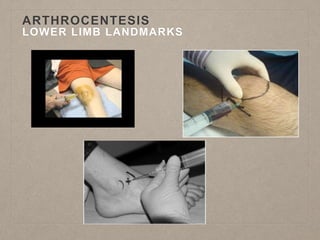 ARTHROCENTESIS
LOWER LIMB LANDMARKS
 
