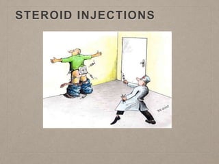 STEROID INJECTIONS
 