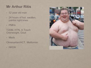 Mr Arthur Ritis
• 52 year old man
• 24 hours of hot, swollen,
painful right knee.
• PMHx
T2DM, HTN, A Touch
Overweight, Gout
• Meds
Olmesartan/HCT, Metformin
• NKDA
 