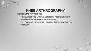 KNEE ARTHROGRAPHYKNEE ARTHROGRAPHY
• HORIZONTAL RAY METHODHORIZONTAL RAY METHOD
• TO DEMONSTRATE LATERAL MENISCUS, POSITION PATIENTTO DEMONSTRATE LATERAL MENISCUS, POSITION PATIENT
SEMIPRONE WITH LATERAL MENISCUS UPSEMIPRONE WITH LATERAL MENISCUS UP
• FOLLOW SAME PROCEDURE USED TO DEMONSTRATE MEDIALFOLLOW SAME PROCEDURE USED TO DEMONSTRATE MEDIAL
MENISCUSMENISCUS
 