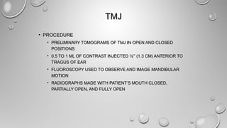 TMJTMJ
• PROCEDUREPROCEDURE
• PRELIMINARY TOMOGRAMS OF TMJ IN OPEN AND CLOSEDPRELIMINARY TOMOGRAMS OF TMJ IN OPEN AND CLOSED
POSITIONSPOSITIONS
• 0.5 TO 1 ML OF CONTRAST INJECTED ½0.5 TO 1 ML OF CONTRAST INJECTED ½′′′′ (1.3 CM) ANTERIOR TO(1.3 CM) ANTERIOR TO
TRAGUS OF EARTRAGUS OF EAR
• FLUOROSCOPY USED TO OBSERVE AND IMAGE MANDIBULARFLUOROSCOPY USED TO OBSERVE AND IMAGE MANDIBULAR
MOTIONMOTION
• RADIOGRAPHS MADE WITH PATIENT’S MOUTH CLOSED,RADIOGRAPHS MADE WITH PATIENT’S MOUTH CLOSED,
PARTIALLY OPEN, AND FULLY OPENPARTIALLY OPEN, AND FULLY OPEN
 