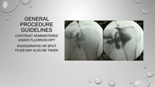 GENERALGENERAL
PROCEDUREPROCEDURE
GUIDELINESGUIDELINES
CONTRAST ADMINISTEREDCONTRAST ADMINISTERED
UNDER FLUOROSCOPYUNDER FLUOROSCOPY
RADIOGRAPHS OR SPOTRADIOGRAPHS OR SPOT
FILMS MAY ALSO BE TAKENFILMS MAY ALSO BE TAKEN
 