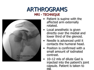 Arthrograms Presentation | PPT
