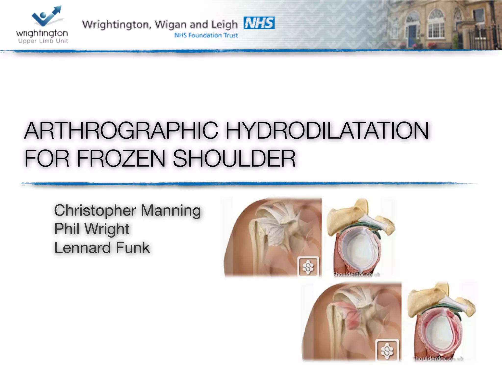 Arthrographic hydrodilatation for frozen shoulder PPT