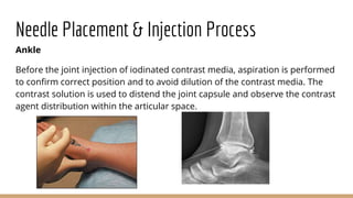 Arthrography of the Shoulder, Ankle and Wrist.pptx