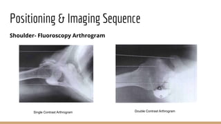 Arthrography of the Shoulder, Ankle and Wrist.pptx