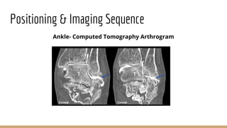 Arthrography of the Shoulder, Ankle and Wrist.pptx