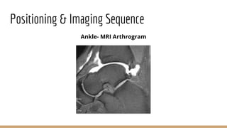 Arthrography of the Shoulder, Ankle and Wrist.pptx