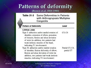 Comprehensive Overview and Management of Arthrogryposis Multiplex ...