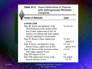 Comprehensive Overview and Management of Arthrogryposis Multiplex ...