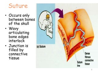 Suture
• Occurs only
between bones
of the skull
• Wavy
articulating
bone edges
interlock
• Junction is
filled by
connective
tissue
9
 
