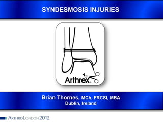 SYNDESMOSIS INJURIES




Brian Thornes, MCh, FRCSI, MBA
        Dublin, Ireland
 