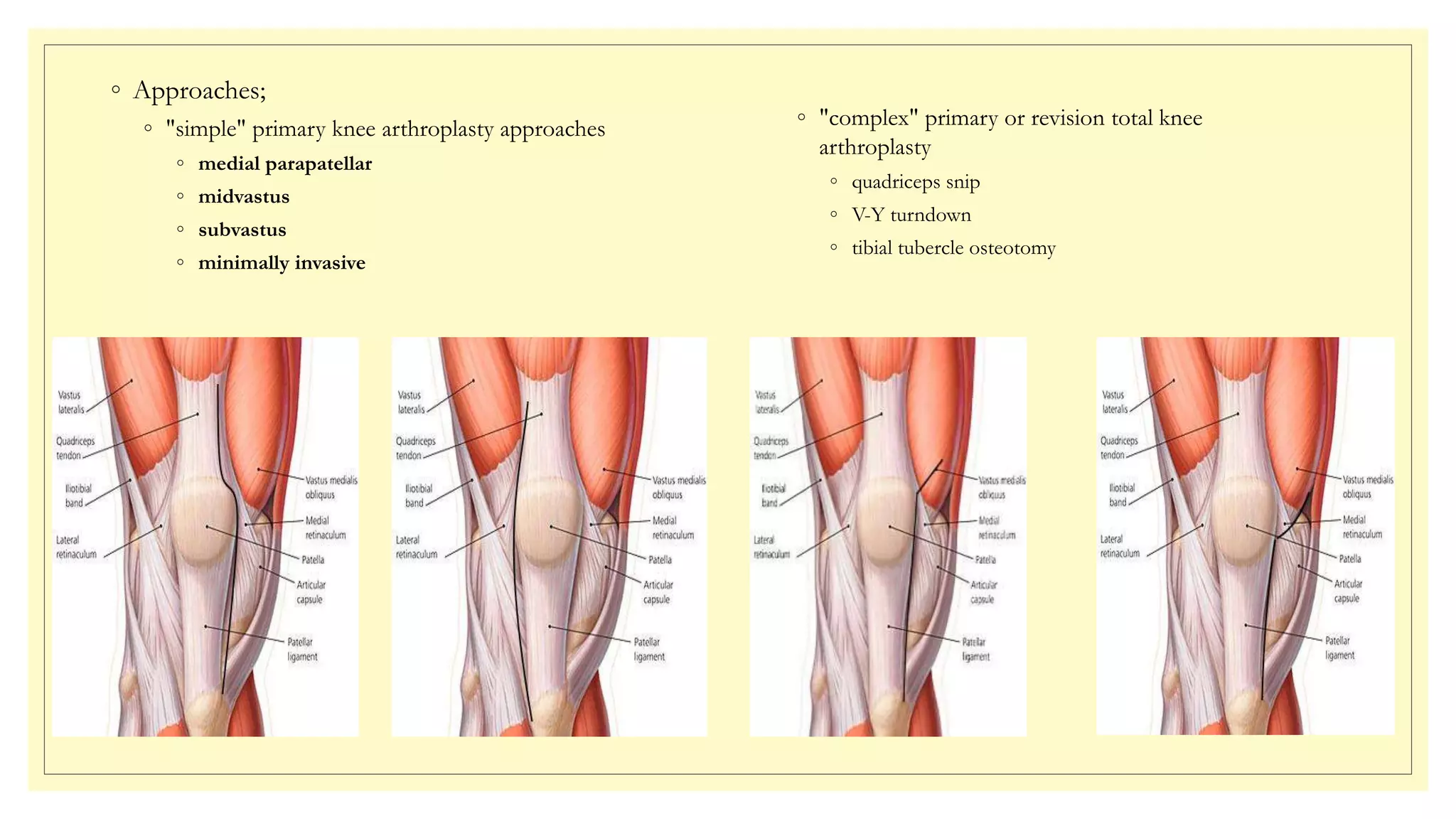 Arthroplasty | PPTX