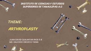 ARTHROPLASTY
JUAN DAVID QUILANTAN RIOS 5 B
MD .SALCEDO OROZCO TANIA
INSTITUTO DE CIENCIAS Y ESTUDIOS
SUPERIORES DE TAMAULIPAS A.C
THEME:
 