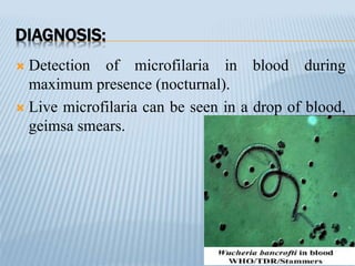 DIAGNOSIS:
 Detection of microfilaria in blood during
maximum presence (nocturnal).
 Live microfilaria can be seen in a drop of blood,
geimsa smears.
 