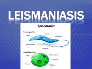 LEISMANIASIS
 