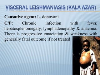 VISCERAL LEISHMANIASIS (KALA AZAR)
Causative agent: L. donovani
C/P: Chronic infection with fever,
hepatosplenomegaly, lymphadenopathy & anaemia.
There is progressive emaciation & weakness with
generally fatal outcome if not treated
 