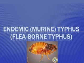 ENDEMIC (MURINE) TYPHUS
(FLEA-BORNE TYPHUS)
 