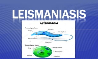 LEISMANIASIS
 