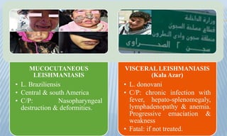 MUCOCUTANEOUS
LEISHMANIASIS
• L. Braziliensis
• Central & south America
• C/P: Nasopharyngeal
destruction & deformities.
VISCERAL LEISHMANIASIS
(Kala Azar)
• L. donovani
• C/P: chronic infection with
fever, hepato-splenomegaly,
lymphadenopathy & anemia.
Progressive emaciation &
weakness
• Fatal: if not treated.
 