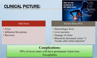 CLINICAL PICTURE:
Mild form
• Fever
• Influenza like picture
• Recovery
Severe form (8%)
• Hemorrhagic fever
• Liver necrosis.
• Damage of retina
• Blurred & decreased vision “1-
3weeks after initial infection”
Complications:
50% of sever cases will have permanent vision loss.
Encephalitis
 