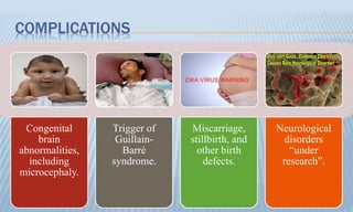 COMPLICATIONS
Congenital
brain
abnormalities,
including
microcephaly.
Trigger of
Guillain-
Barré
syndrome.
Miscarriage,
stillbirth, and
other birth
defects.
Neurological
disorders
“under
research”.
 