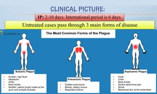 CLINICAL PICTURE:
Untreated cases pass through 3 main forms of disease
IP: 2-10 days. International period is 6 days.
 