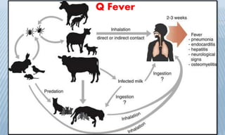 Q Fever
 