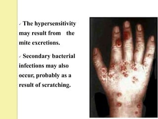    The hypersensitivity
may result from the
mite excretions.

   Secondary bacterial
infections may also
occur, probably as a
result of scratching.
 
