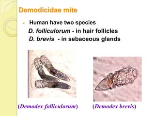 Demodicidae mite
    Human have two species
     D. folliculorum - in hair follicles
     D. brevis - in sebaceous glands




(Demodex folliculorum)       (Demodex brevis)
 
