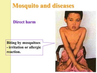 Mosquito and diseases

    Direct harm



Biting by mosquitoes
- irritation or allergic
reaction.
 