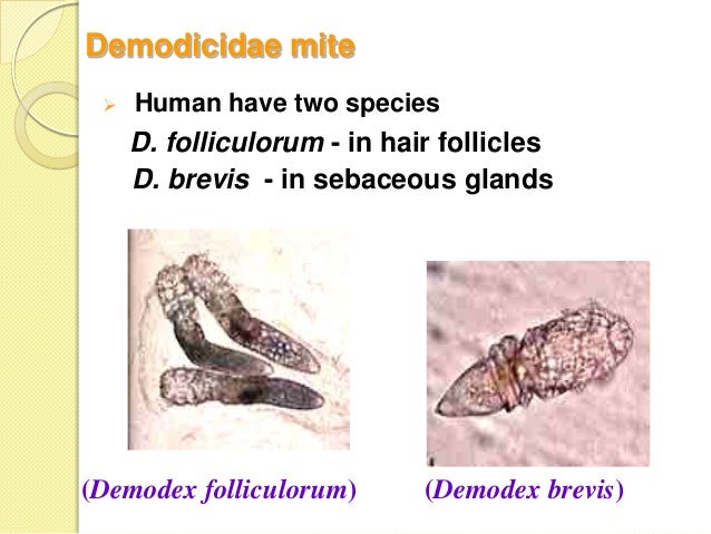 Demodicidae - Image - Demodex folliculorum | BioLib.cz