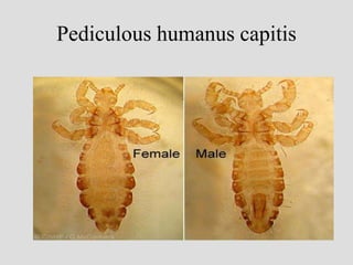 Pediculous humanus capitis
 
