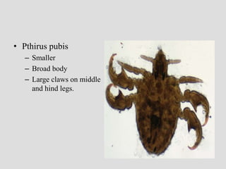 • Pthirus pubis
– Smaller
– Broad body
– Large claws on middle
and hind legs.
 