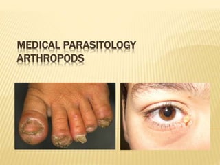 MEDICAL PARASITOLOGY
ARTHROPODS
 