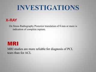 Arthroscopic pcl reconstruction | PPTX