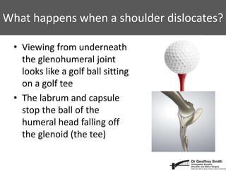 What happens when a shoulder dislocates?
• Viewing from underneath
the glenohumeral joint
looks like a golf ball sitting
on a golf tee
• The labrum and capsule
stop the ball of the
humeral head falling off
the glenoid (the tee)
 