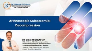 Arthroscopic Subacromial Decompression { Best Shoulder Arthroscopy Surgeon in Delhi