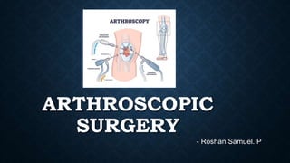 ARTHROSCOPIC
SURGERY
- Roshan Samuel. P
 