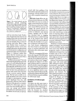 Arthroscopic Treatment of Anterior Glenohumeral Instability Indications and Techniques | Vail Sports Medicine