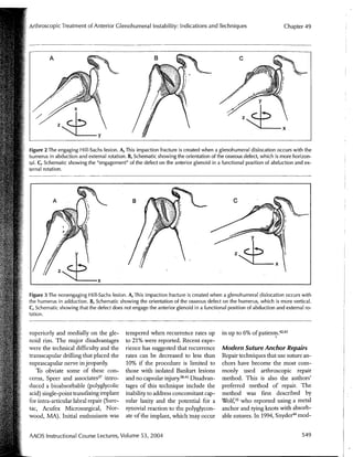 Arthroscopic Treatment of Anterior Glenohumeral Instability Indications and Techniques | Vail Sports Medicine